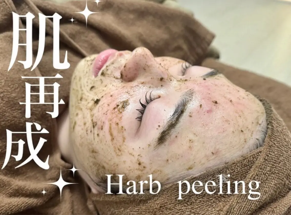 人気No.1👑【剥けない♪本格ニキビケア】話題の陶器肌ハーブピーリング✨敏感肌の方にも安心◎の写真