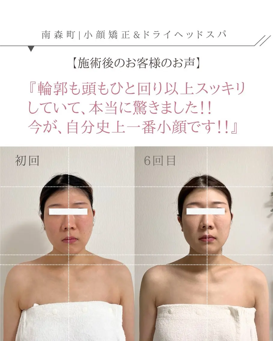 🌿 30代限定 3ヶ月間(6回来店条件)90分【フェイスラインすっきり小顔ヘッドスパ】の写真
