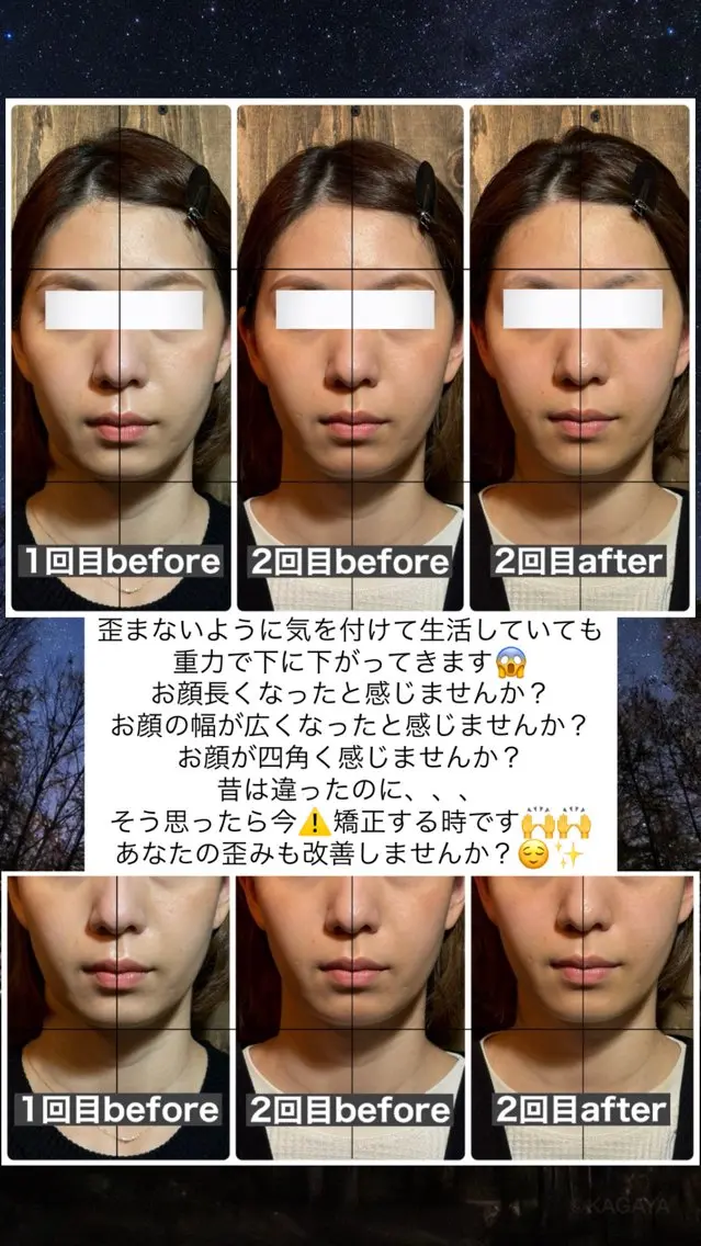 エステ リラク 💎後悔させない小顔 矯正💎イトヤマ🌱のエステ・リラクイメージ
