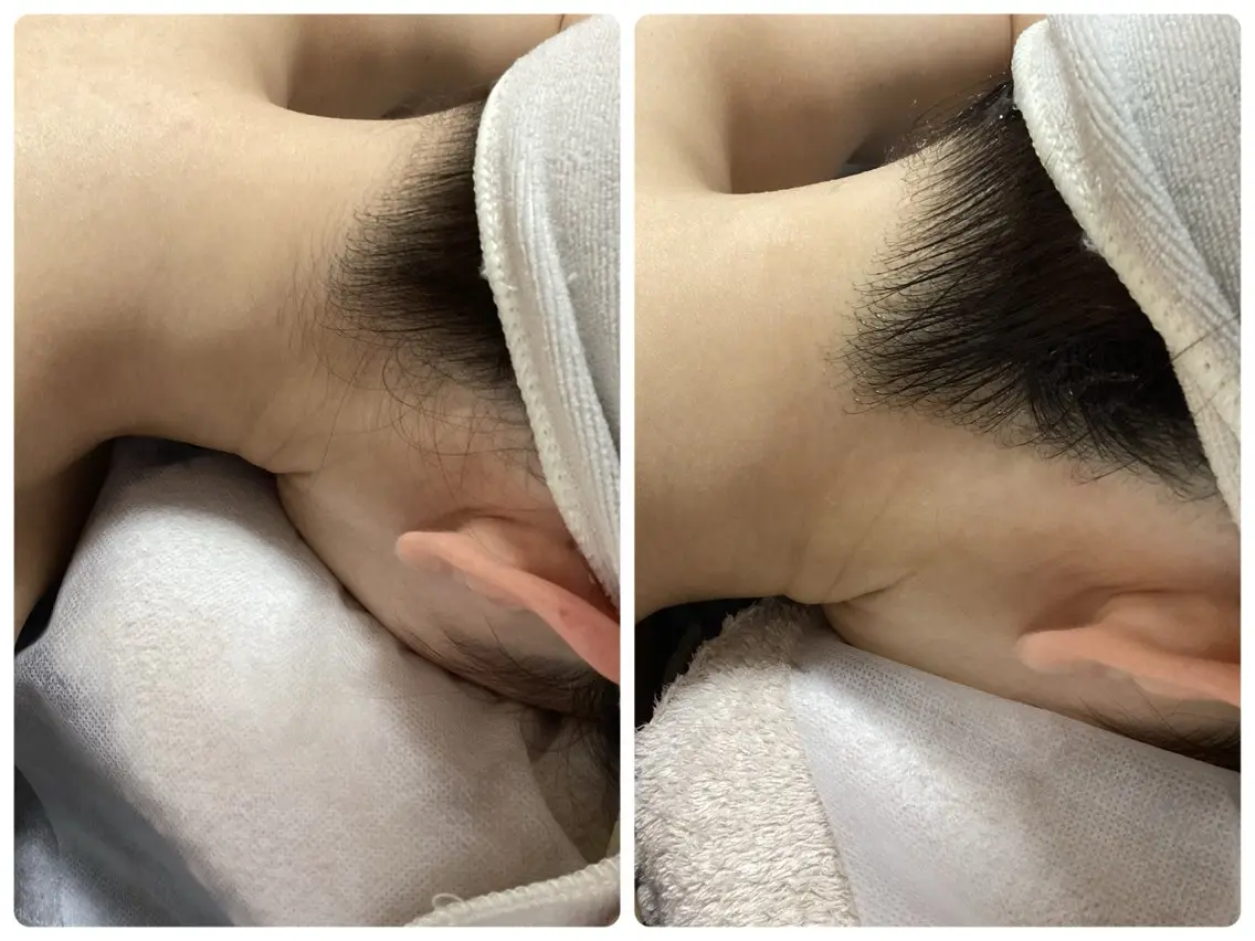 脱毛 脱毛専門減毛サロン LULU.tokyoのエステ・リラクイメージ