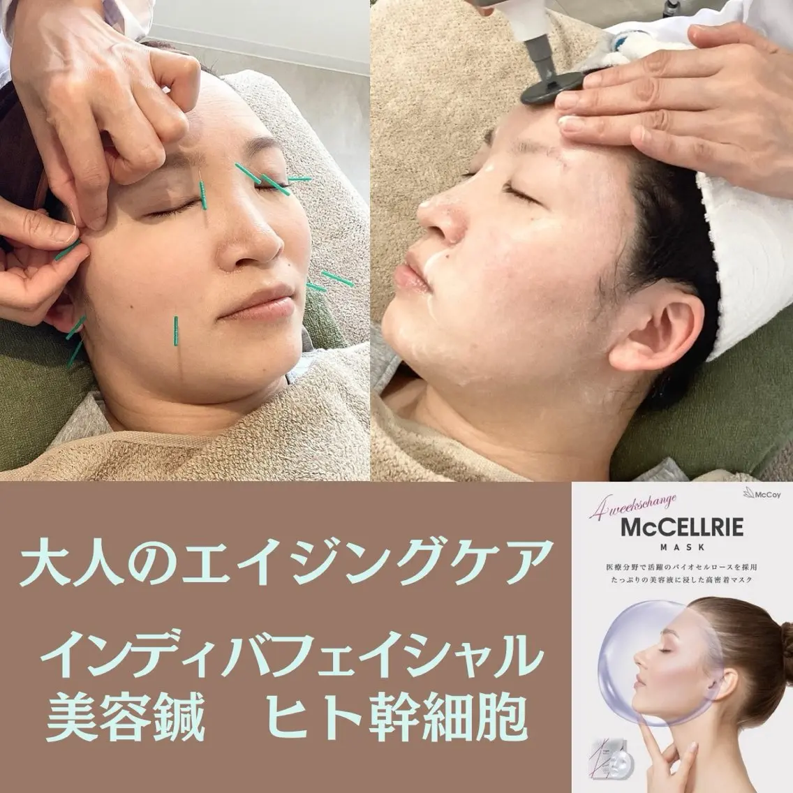美容鍼&温活・免活 さくらんぼ鍼灸院のエステ・リラクイメージ