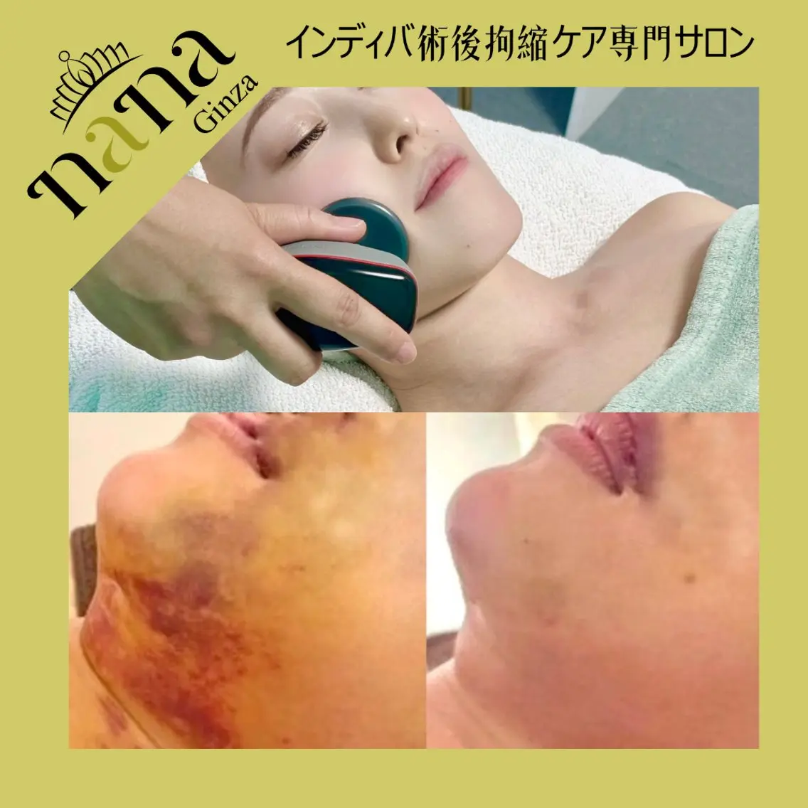 エステ Nana銀座Nina 高周波温熱専門サロンのエステ・リラクイメージ