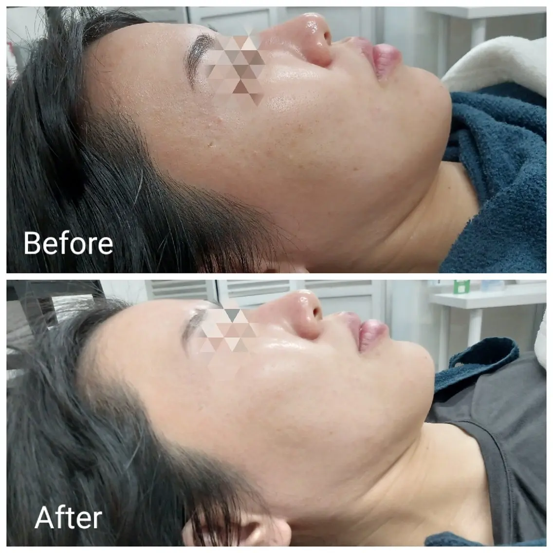 エステ リラク 肌質改善Beauty salon Renのエステ・リラクイメージ