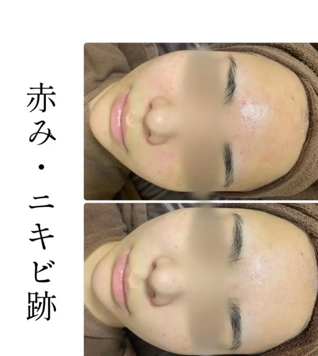 エステ ハーブピーリング専門 BIOPLUS+川崎のエステ・リラクイメージ