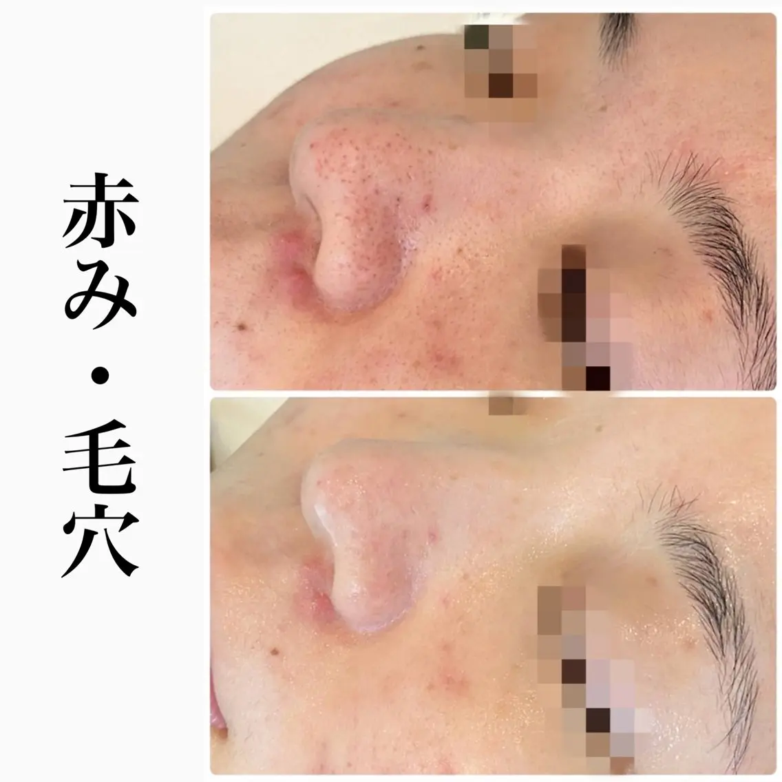 エステ ハーブピーリング専門 BIOPLUS+川崎のエステ・リラクイメージ