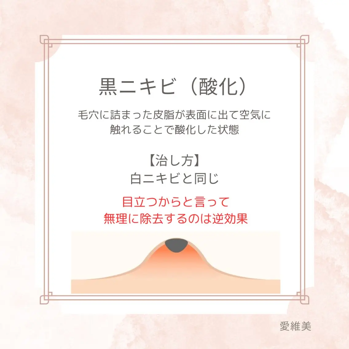 マツエク・マツパ エステ リラク 愛維美水光美肌専門店 メンズレディースokのエステ・リラクイメージ