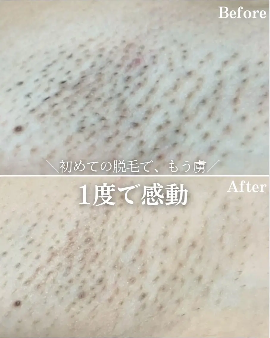 abeshial 〜美・健康・笑顔〜の眉毛・アイブロウイメージ