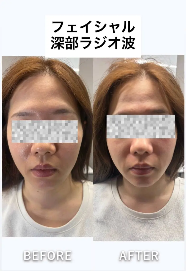 エステ 痩身・脱毛・肌管理 Rechica心斎橋のエステ・リラクイメージ