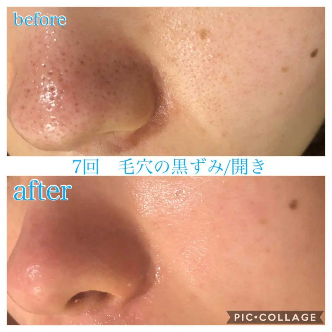 ロング カラー パーマ ヘアアレンジ メンズ ネイル マツエク・マツパ エステ リラク EnsorClair 代表 野口真央のエステ・リラクイメージ
