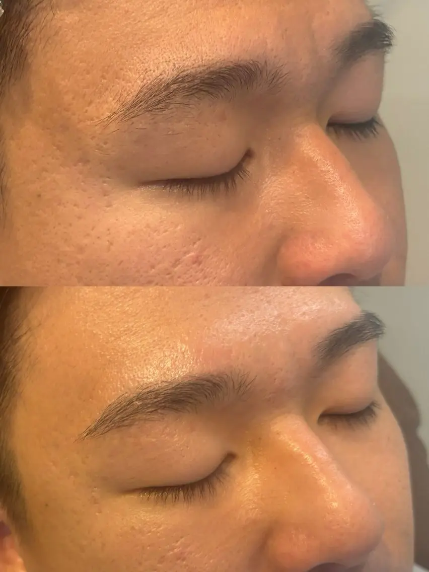 メンズ アイブロウ ワックス脱毛 眉カット その他(アイブロウ) **メンズアイブロウ 五反田**SACHIの眉毛・アイブロウイメージ
