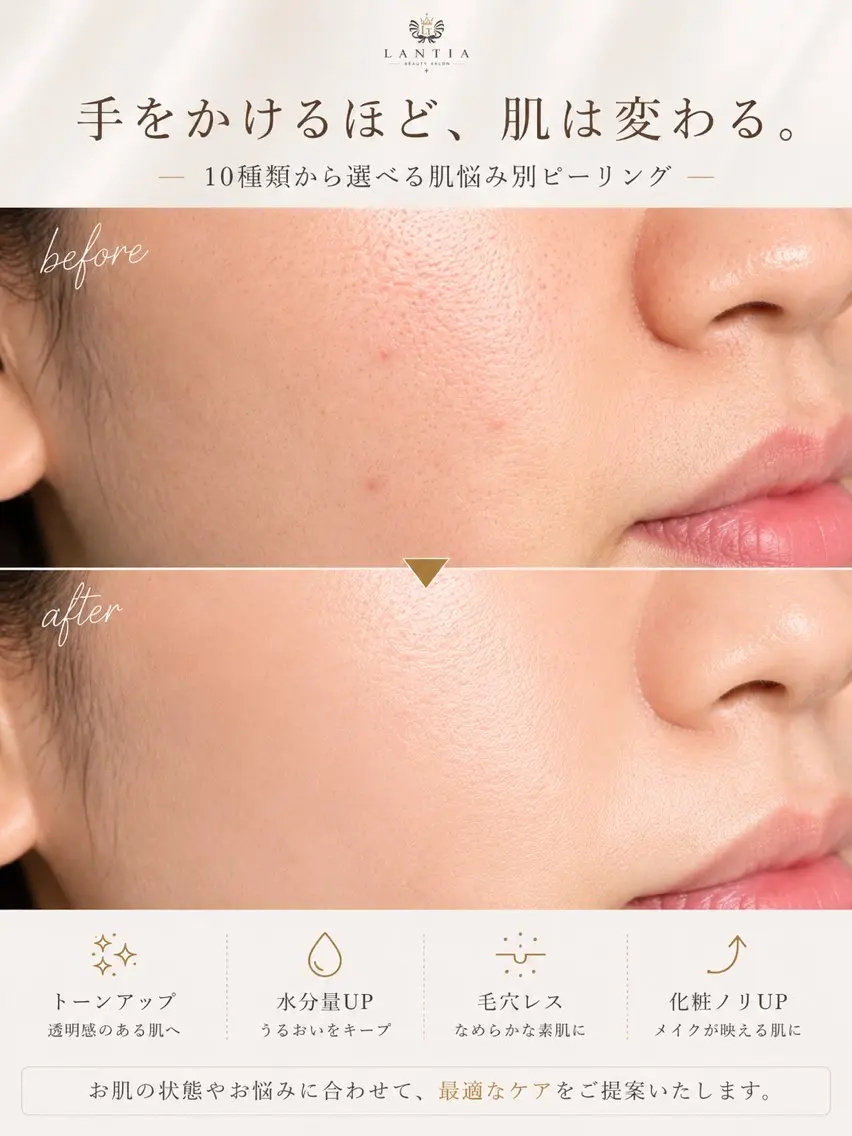 エステ LANTIA 肌改善ホワイトニングのその他イメージ