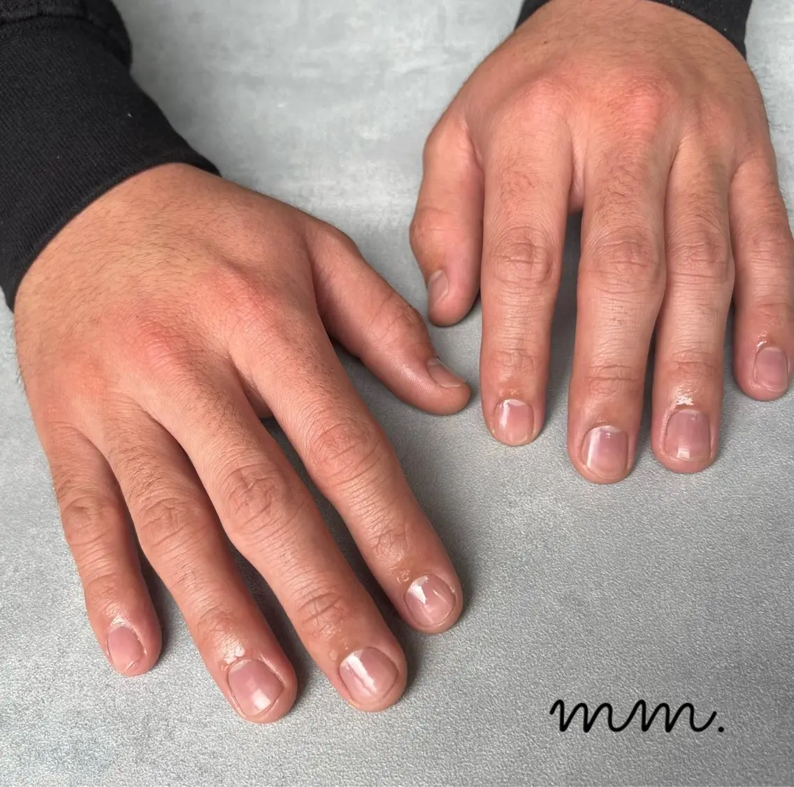 💛【MENS】男の身だしなみ💛爪まわり角質ケア¥3500の写真