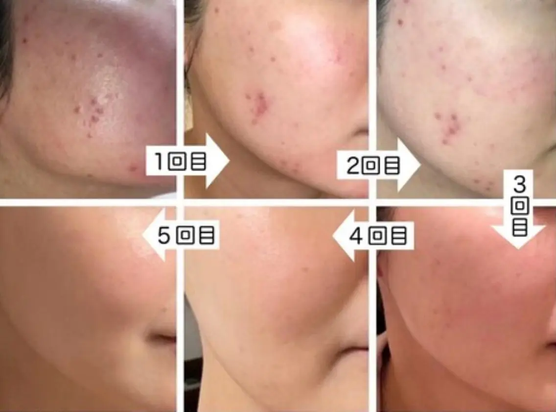 佐藤 加奈のエステ・リラクイメージ
