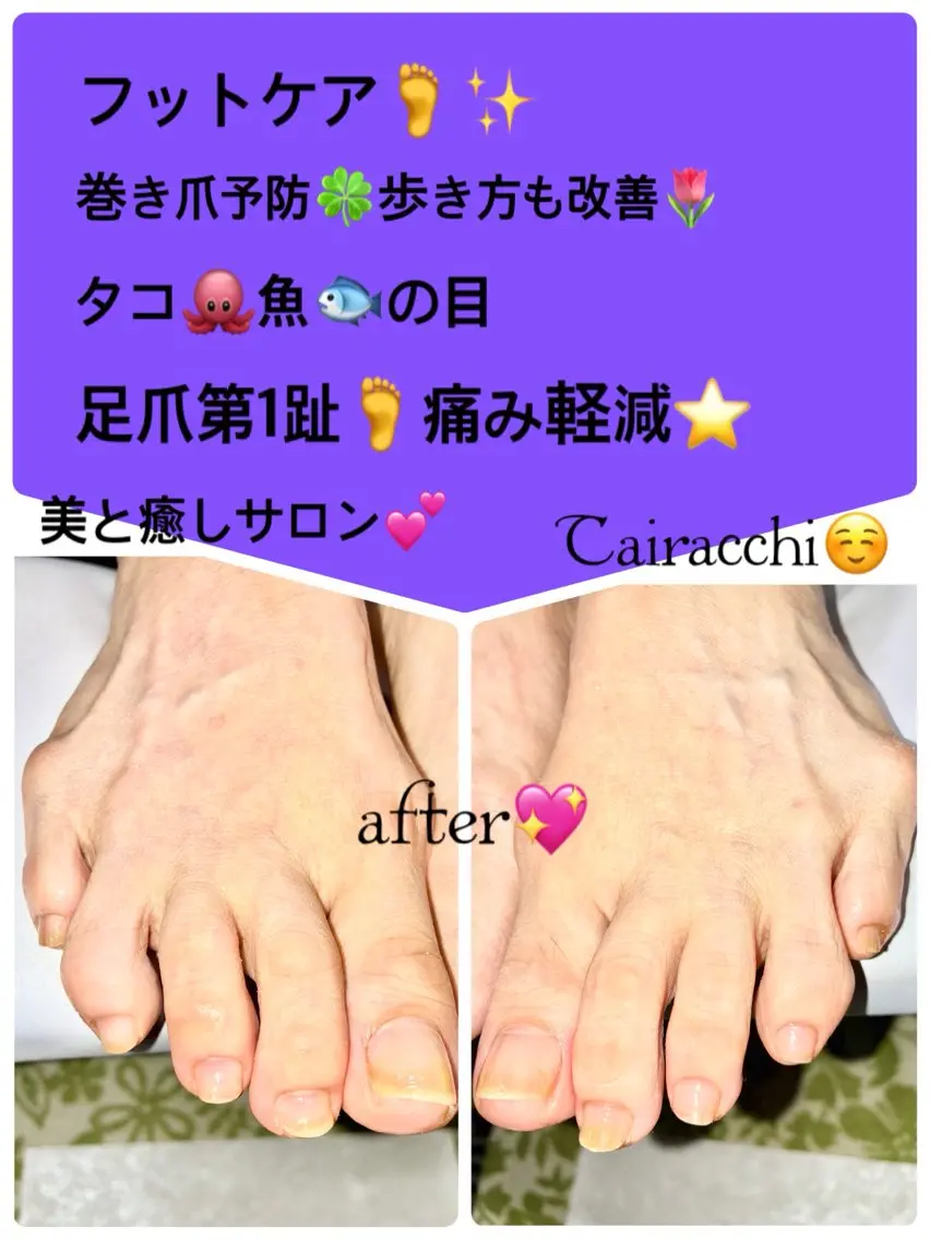 ネイル フットネイル Tairacchi タイラッチのエステ・リラクイメージ