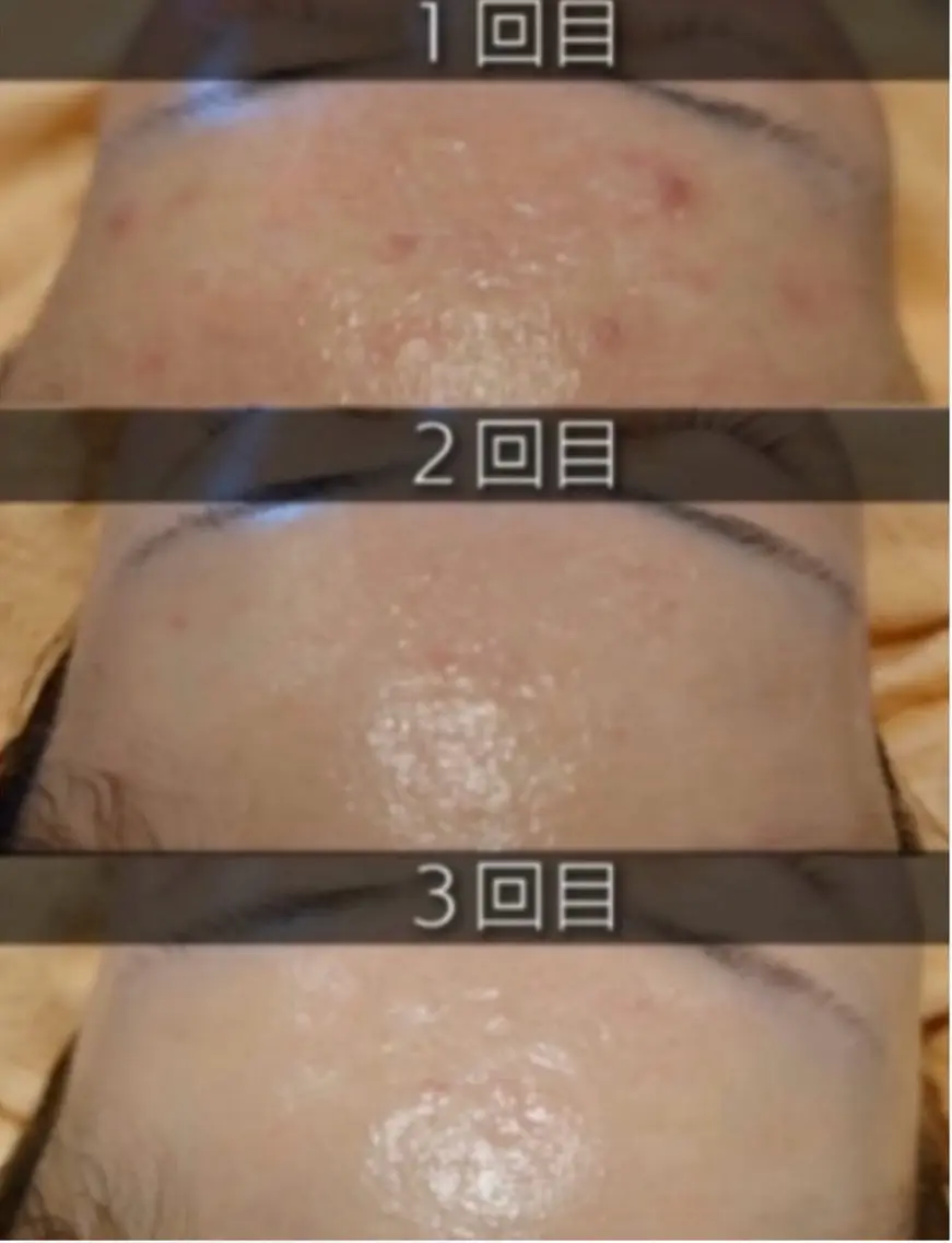 esthesalon O'-en-のエステ・リラクイメージ