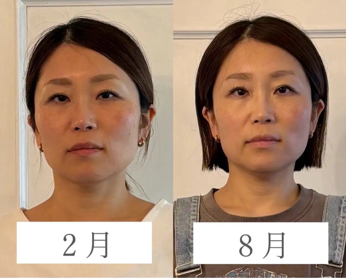 足から整える小顔矯正 全身美容矯正/中目黒のエステ・リラクイメージ