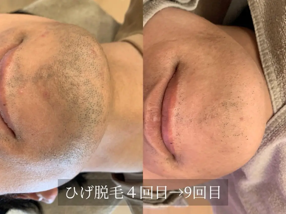 脱毛サロン Arumのエステ・リラクイメージ