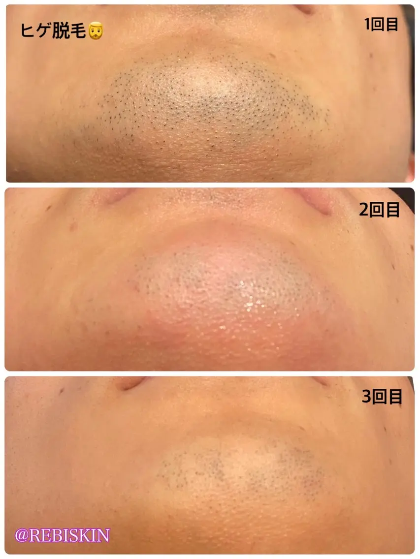 冷えむくみ改善専門 REBISKIN🌿のその他イメージ