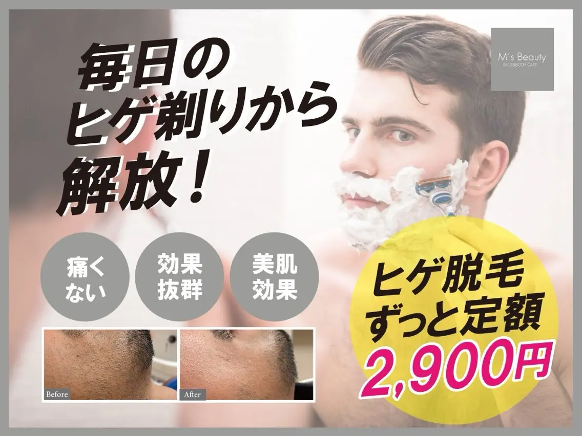 メンズヒゲ脱毛の写真