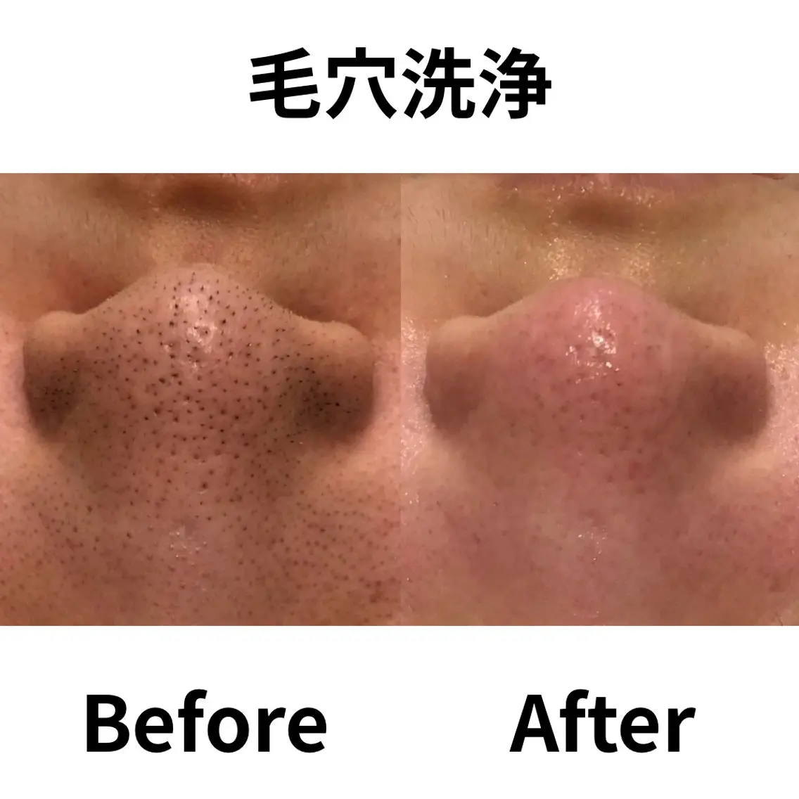 林 陽向のエステ・リラクイメージ