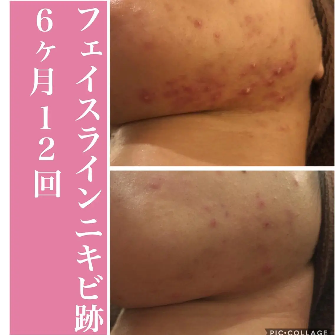 ミディアム カラー パーマ ヘアアレンジ メンズ キッズ ネイル マツエク・マツパ アイブロウ ニキビ・肌質改善専門 ♡人生が変わるサロンのエステ・リラクイメージ