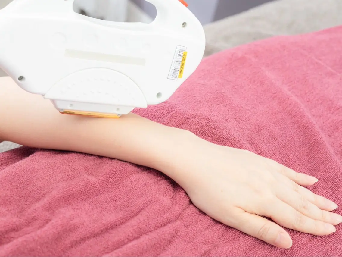 【夏までにツルツルお肌へ】腕・脱毛の写真
