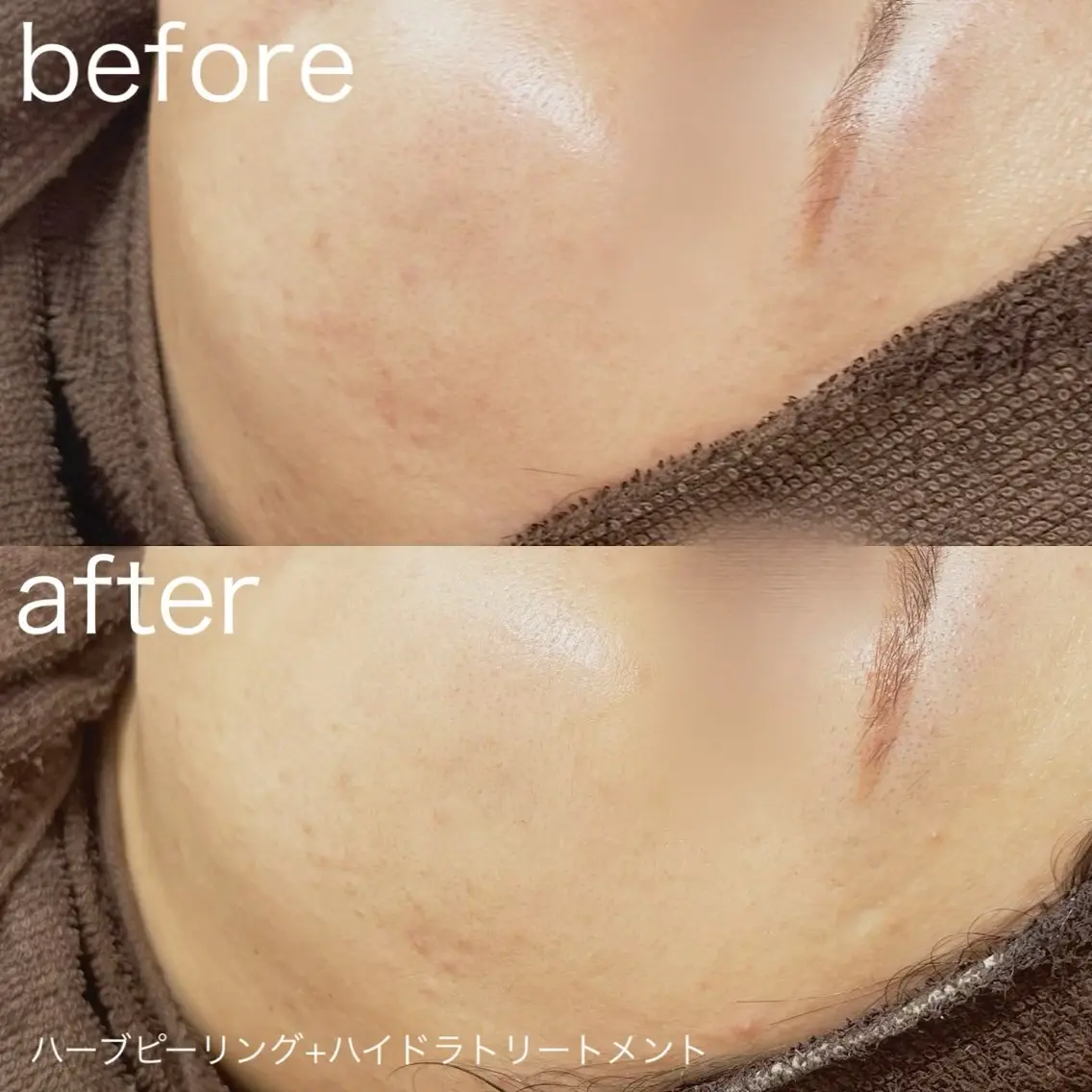 その他 lulularico Yuのネイルデザイン