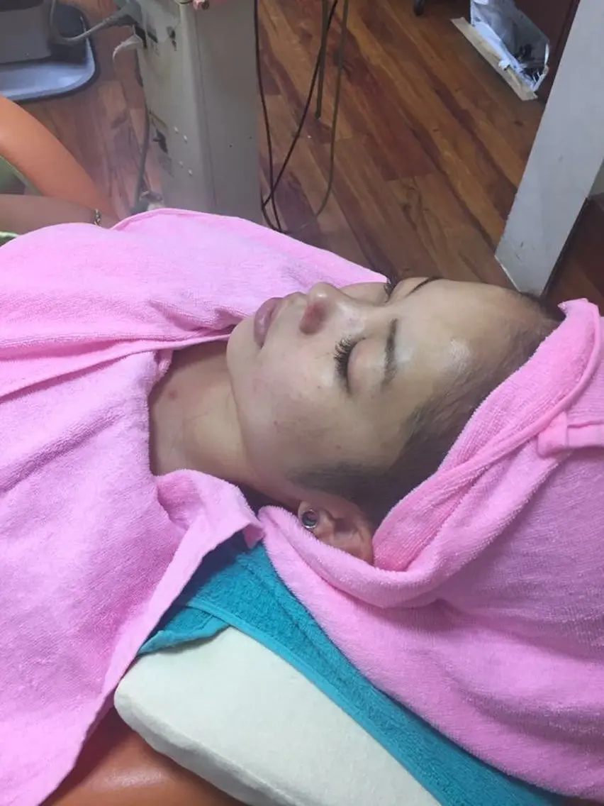 女性お顔剃り　炭酸お顔剃り等の写真