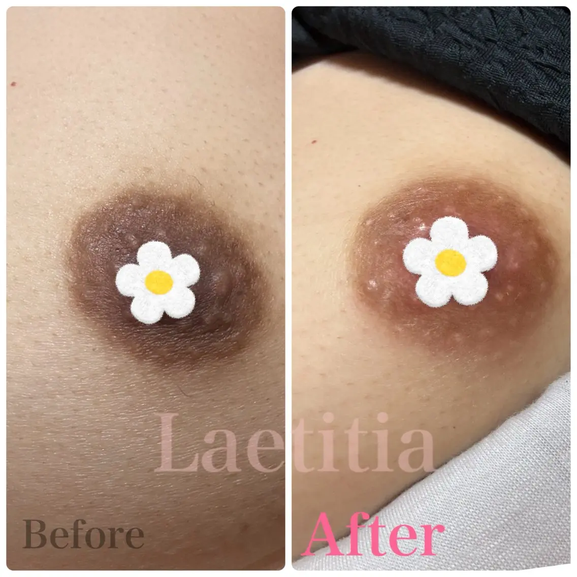 レティティア (Laetitia)のエステ・リラクイメージ