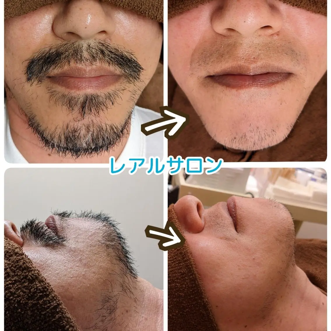 脱毛 レアルサロン YUTAKAのエステ・リラクイメージ