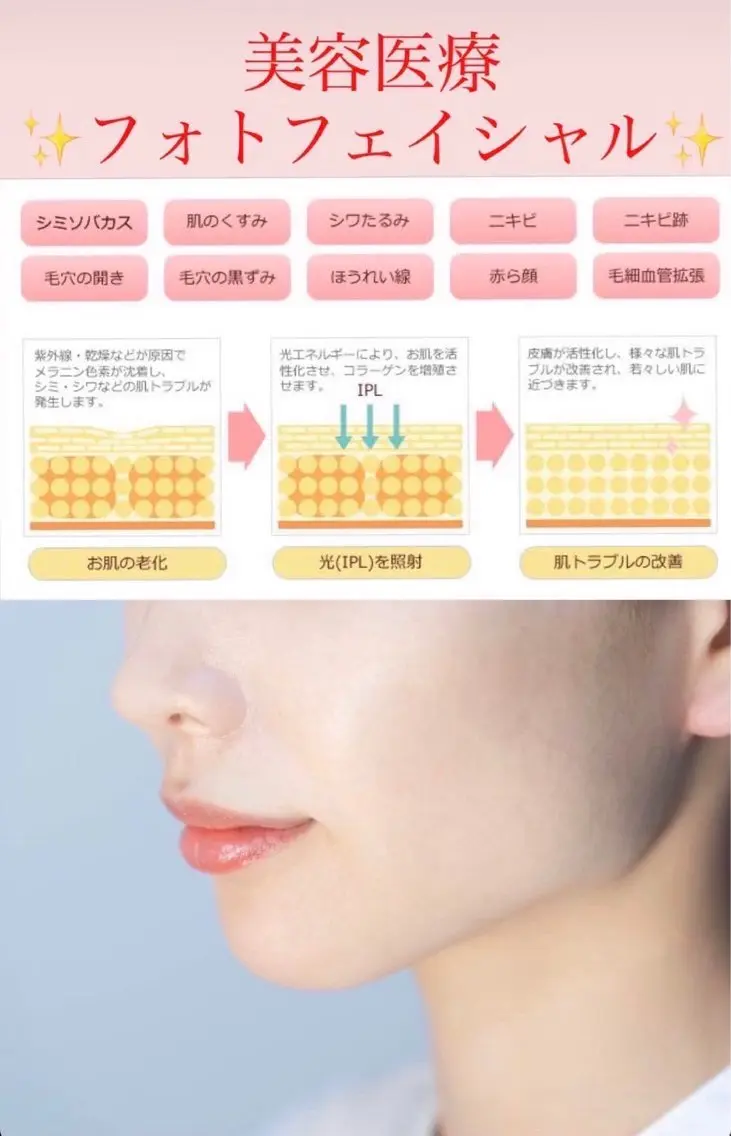 メンズ 脱毛SALON RaYNiCKのエステ・リラクイメージ