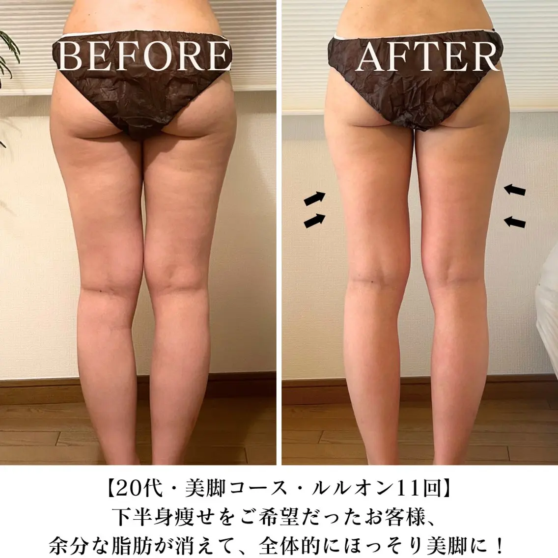 【美脚コース】ヒップ・太もも猛烈アタック  ¥11000→¥6800  100分の写真