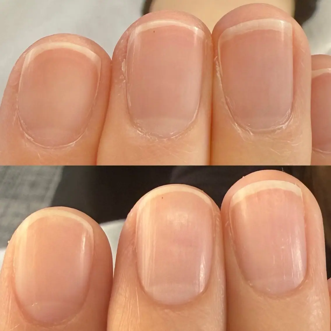 ネイルケア （育成アドバイスなし）の写真