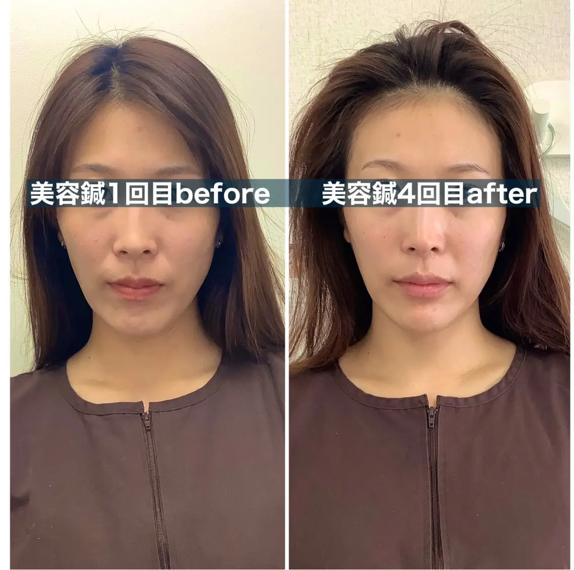 美容鍼灸×小顔整体♡ ハリサロンドオフ堺東のその他イメージ