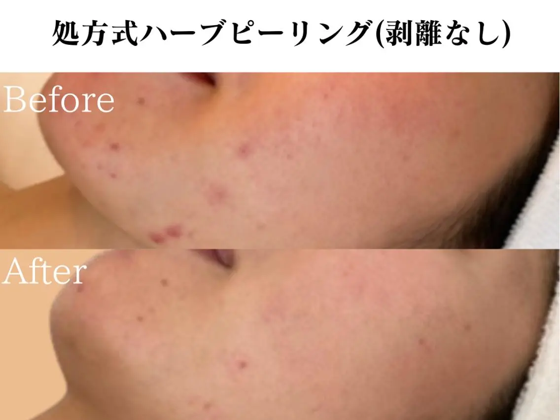 エステ リラク 🌿OmoteAri 心斎橋✨エステサロンのエステ・リラクイメージ