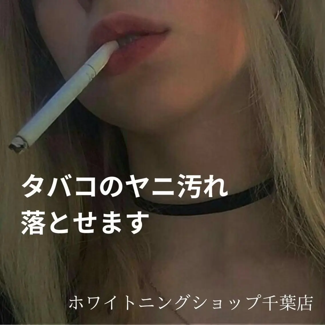 メンズ その他 ホワイトニング ショップ千葉店のその他イメージ