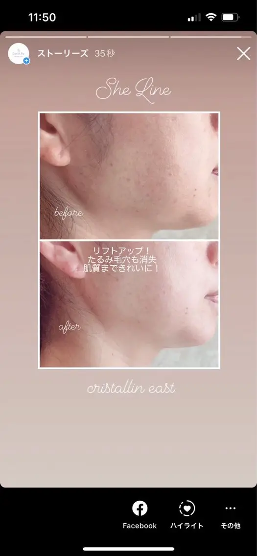 クリスタラン イーストのエステ・リラクイメージ