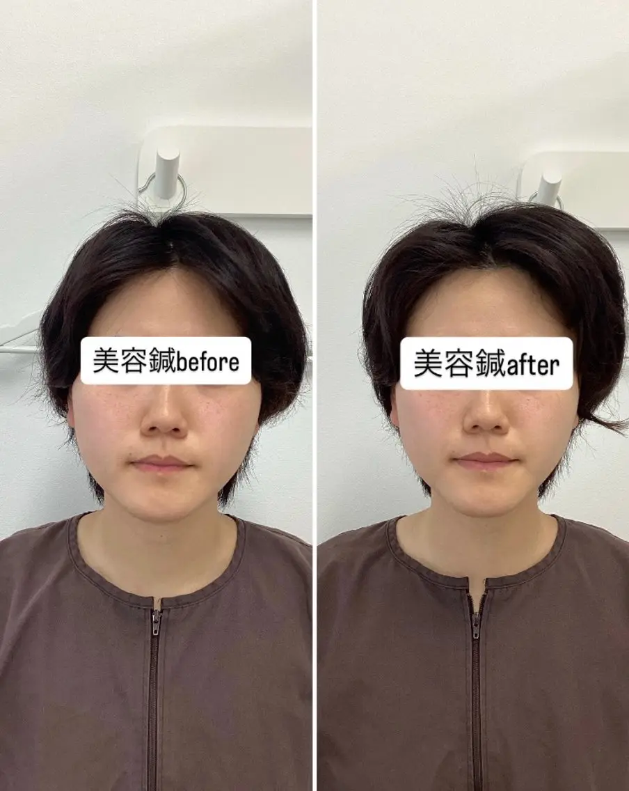 美容鍼灸×小顔整体♡ ハリサロンドオフ堺東のその他イメージ