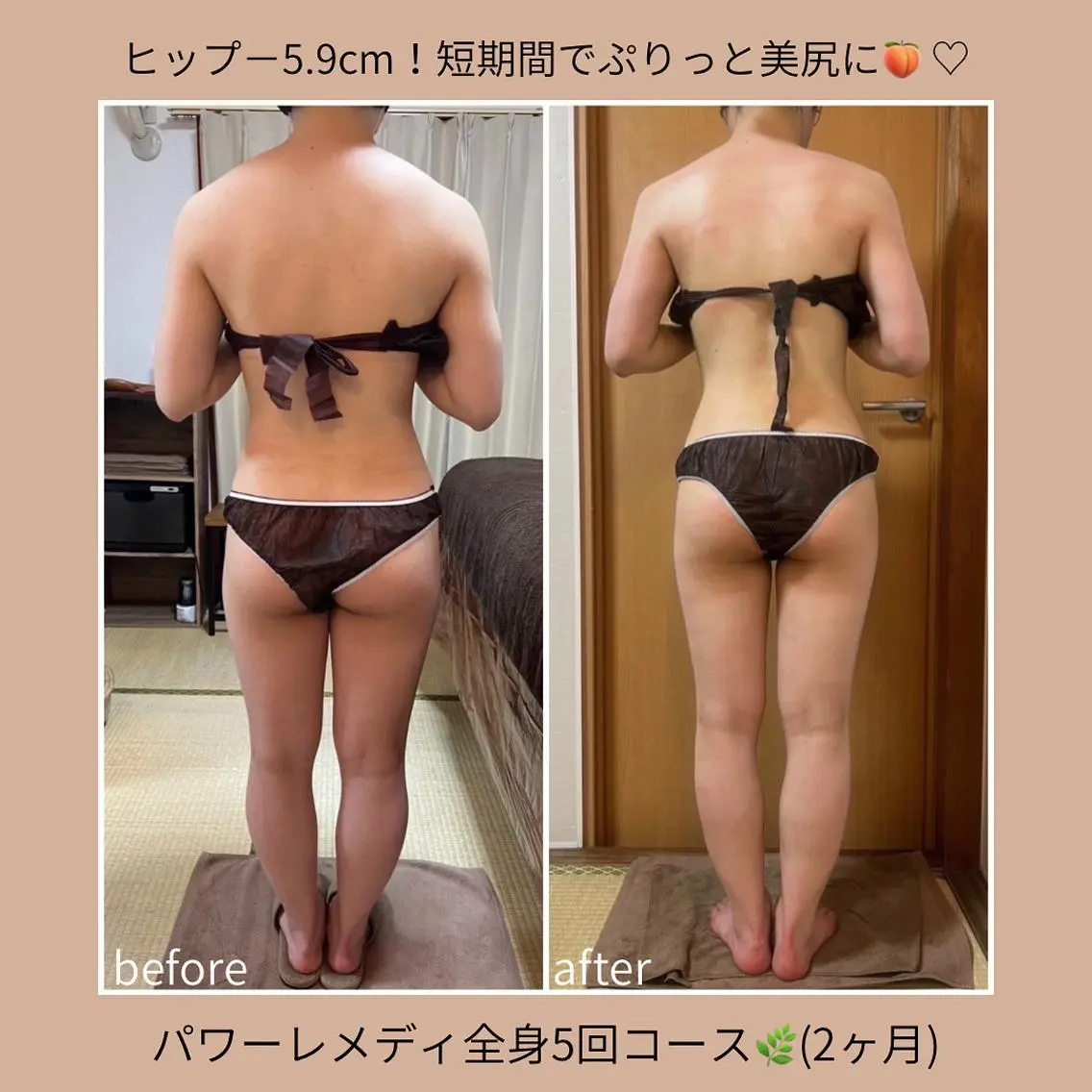 《本気痩せ×疲労改善 》  BILOOPのエステ・リラクイメージ