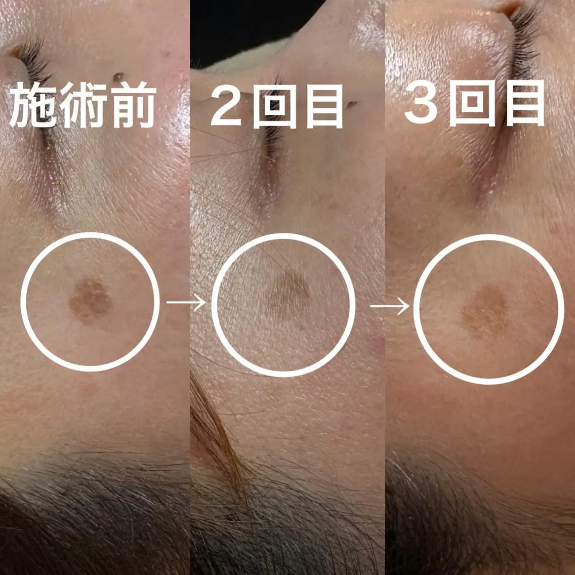 その他 LUMY GRATiAEのエステ・リラクイメージ