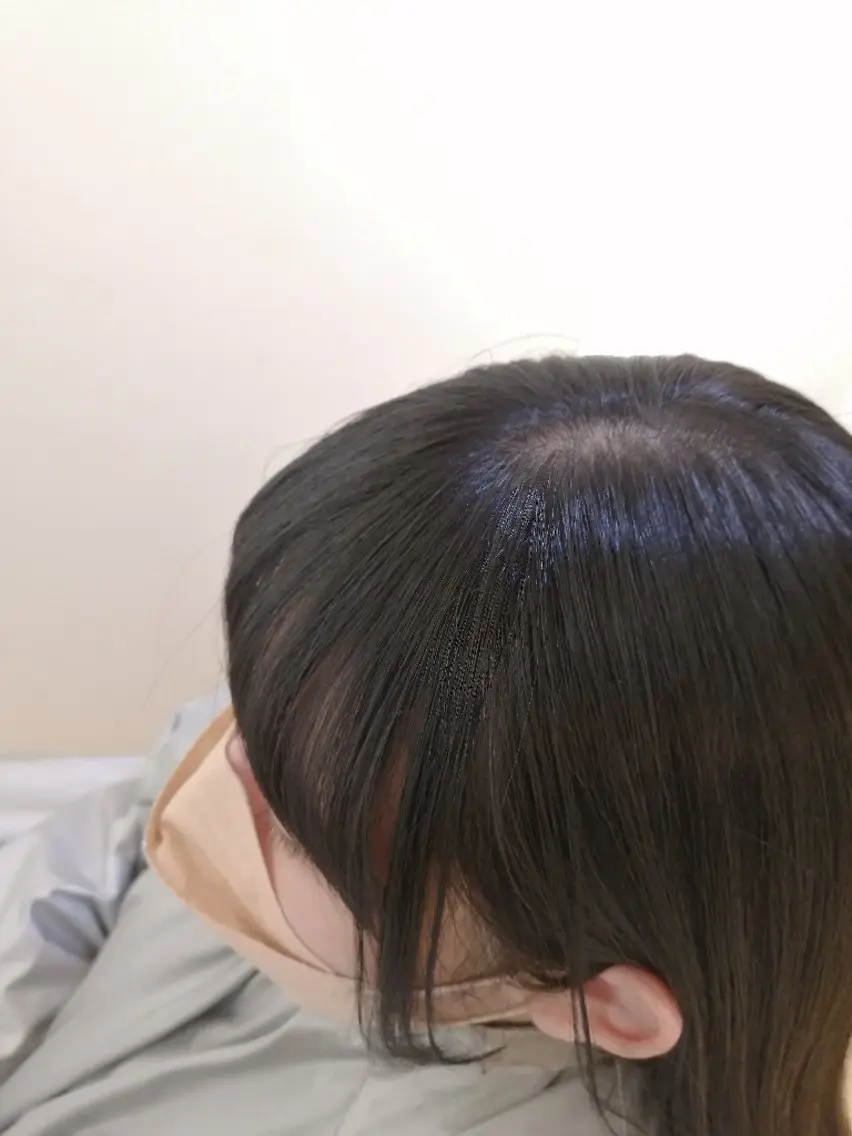 前髪のうねりをなんとかしたい!そんなアナタに。(前髪縮毛+前髪カット)の写真