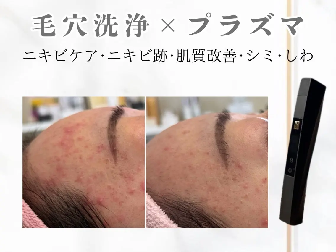 エステ オンダリフト・美肌 Red しずるのエステ・リラクイメージ