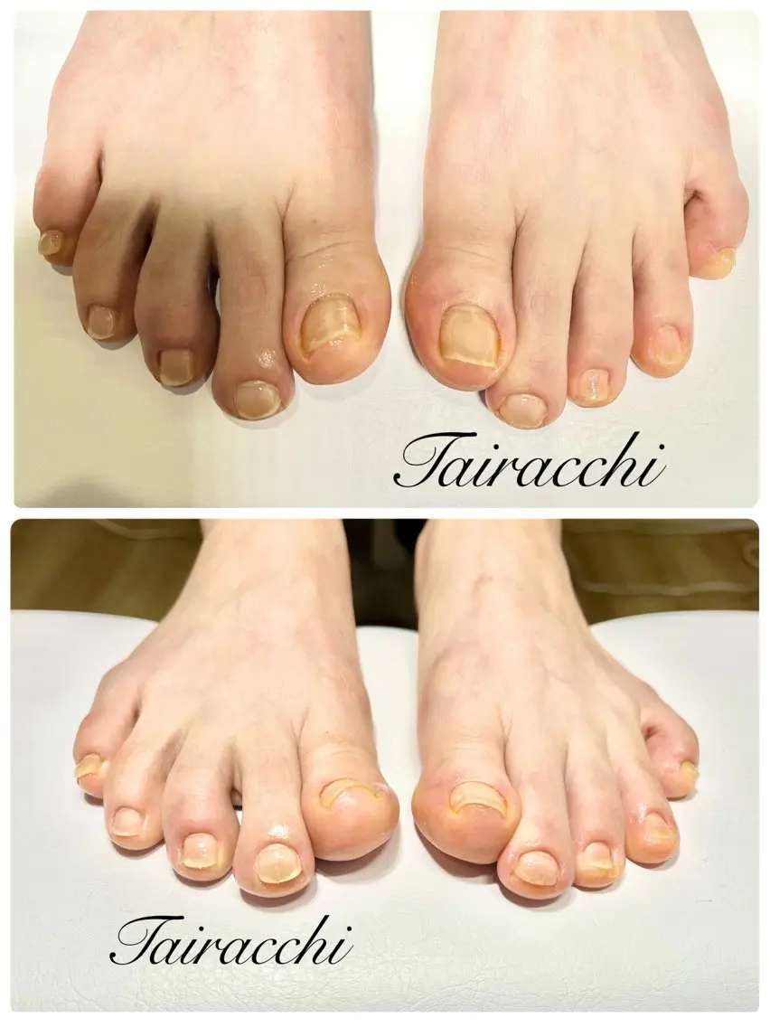 ネイル フットネイル ジェルネイル フットネイル Tairacchi タイラッチのエステ・リラクイメージ