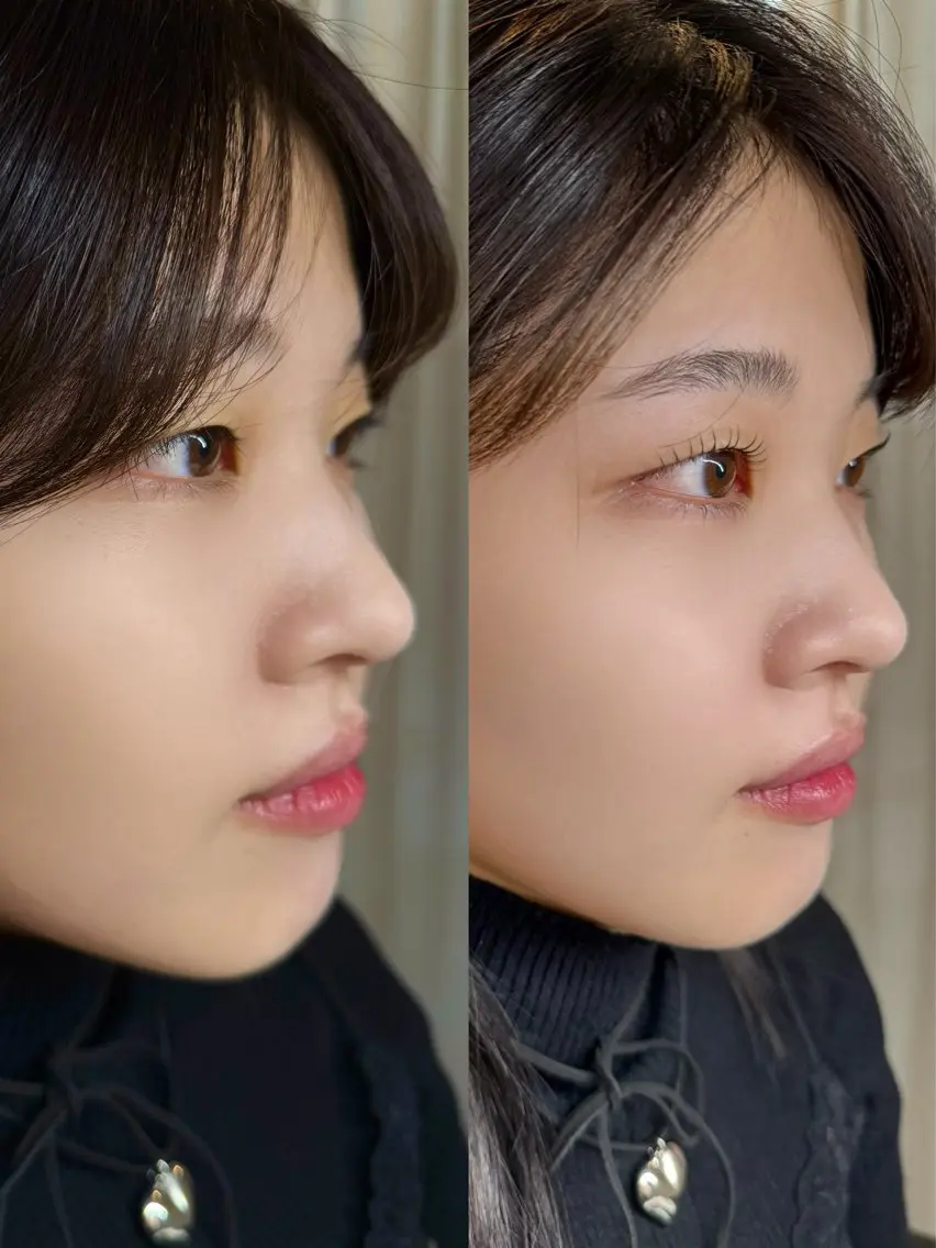 まつ毛パーマ上下の写真