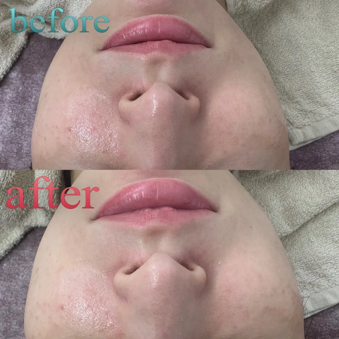 エステ ナスサロ Reikaのエステ・リラクイメージ