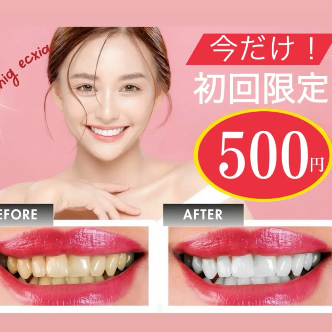【1日2名限定★】リピート率90%◎セルフホワイトニング9分×2回の写真