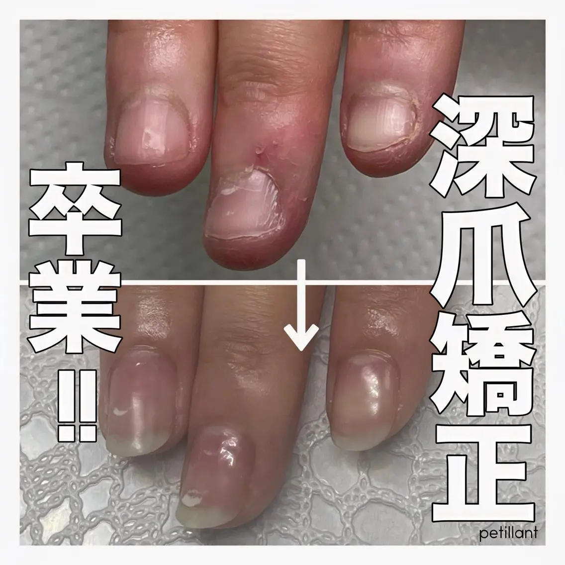 ネイル 入学式 卒業式 ピンク ハンドネイル ハンドケア nail salon petillantのネイルデザイン