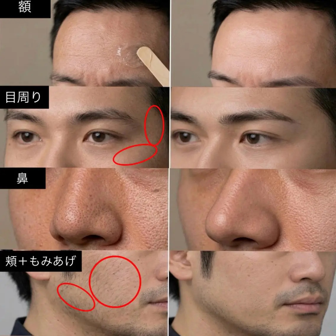 眉毛ワックス+顔の産毛ワックス(選べる1部位)の写真
