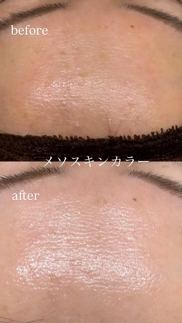 エステ リラク 肌質改善サロン réposのその他イメージ
