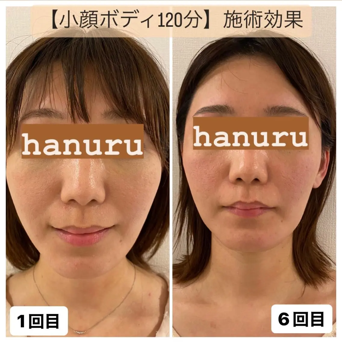 【人気No1】小顔ボディ120分　【立体美へ・小型化・顔に触れずに小顔にする】の写真